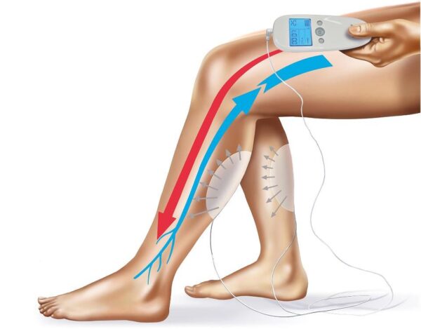 leg veins and arteries e1608148747493